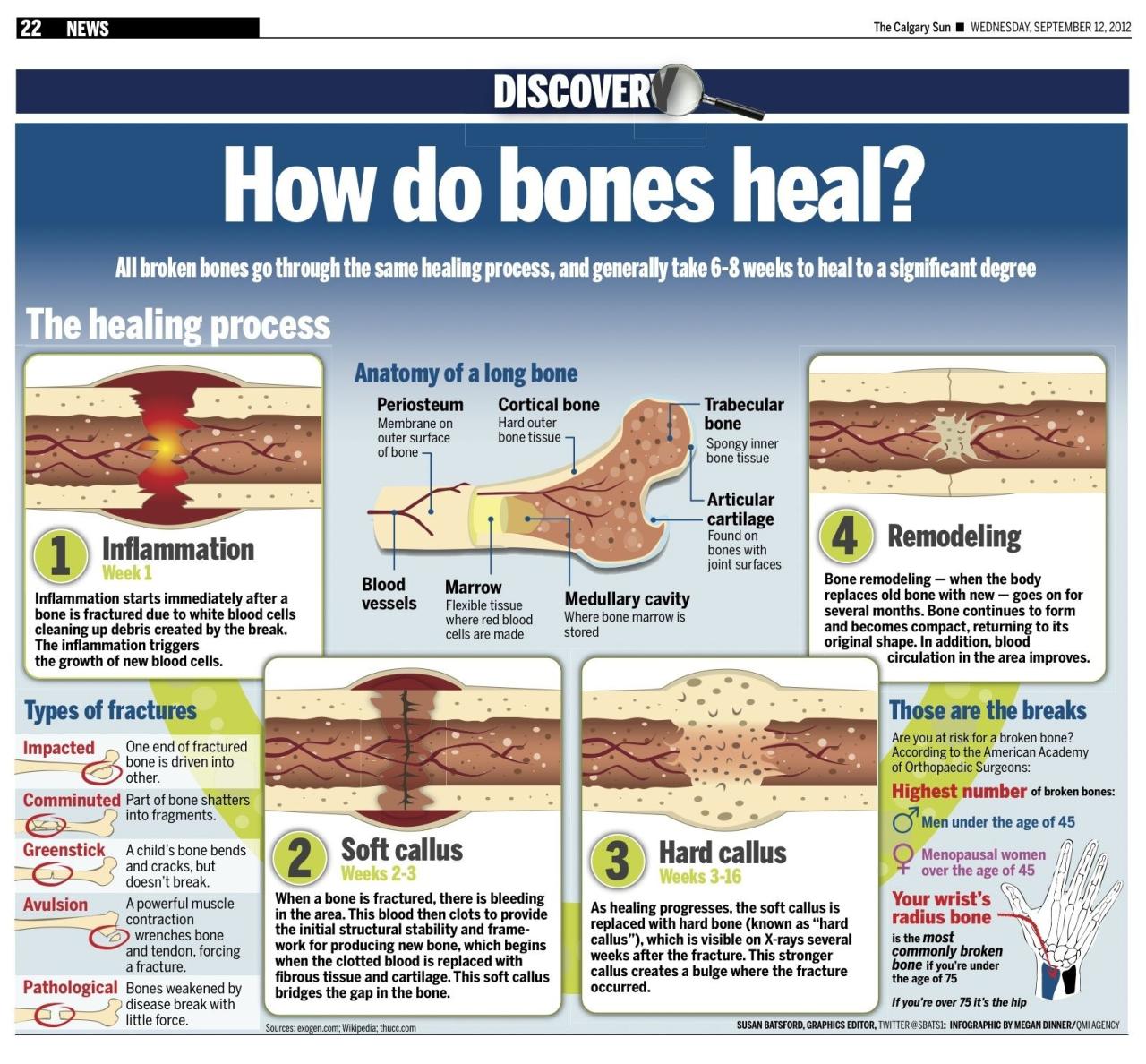Healing bone fracture stress recovery process after broken heals during nsaids google graphic why