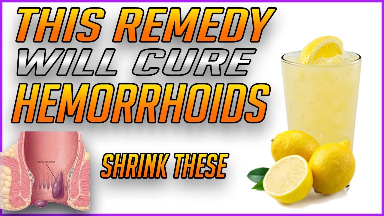 Hemorrhoids remedy
