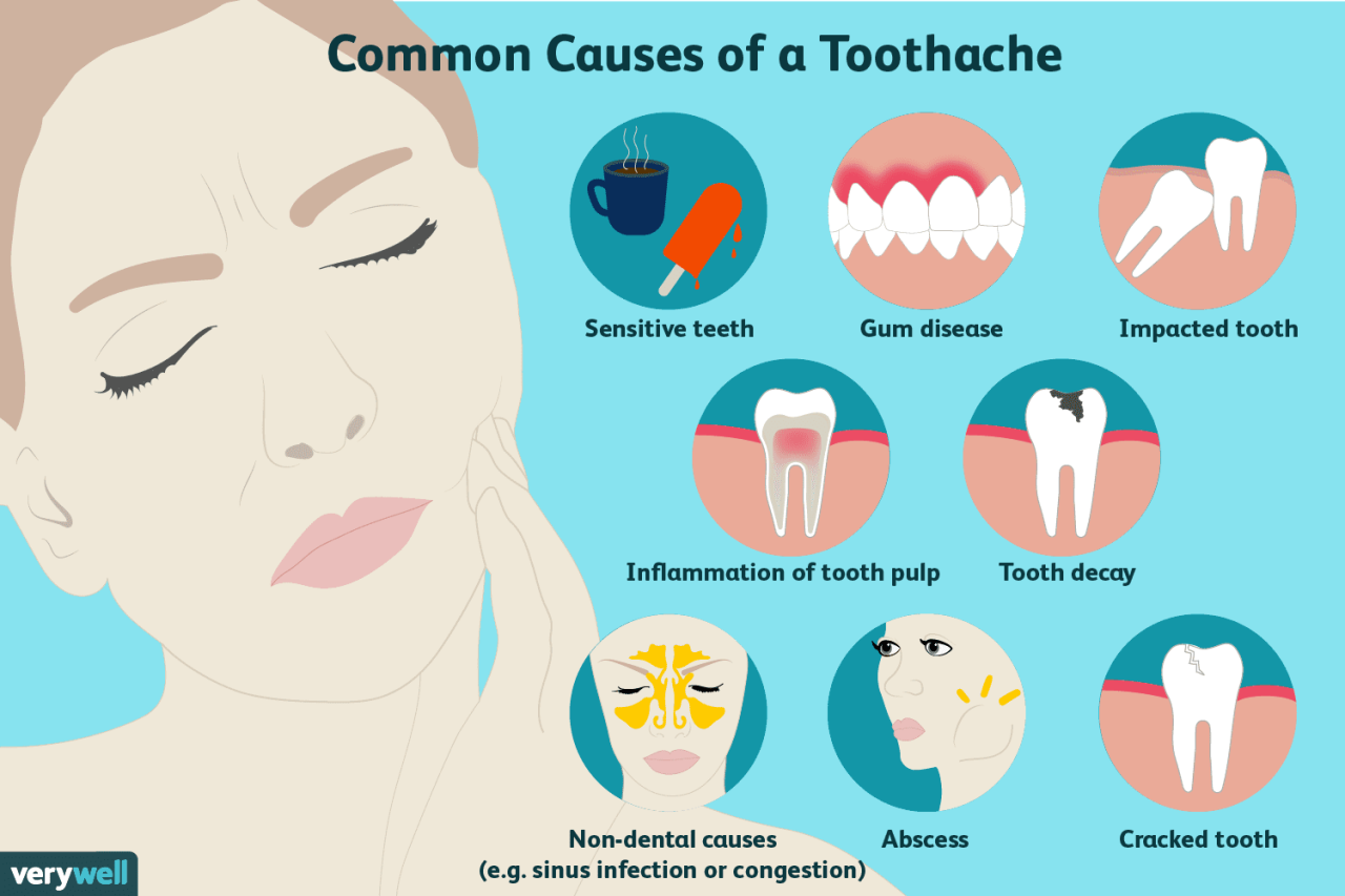 Kenapa sakit gigi tidak sembuh sembuh