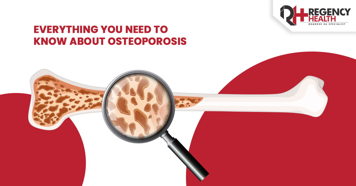 Osteoporosis density