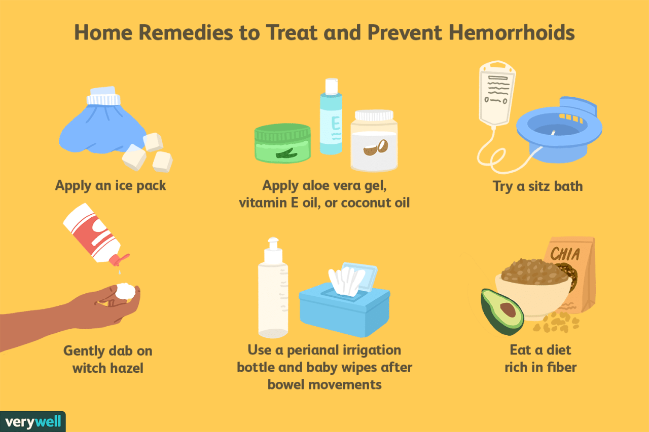 Hemorrhoids cure remedy heal rid fast naturally