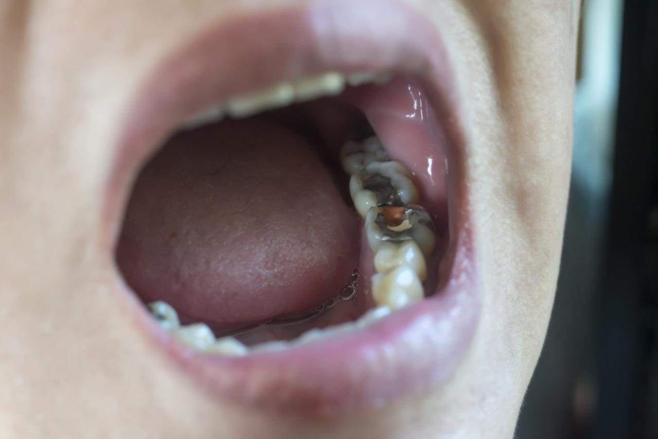 Toothache dentist emergency throbbing