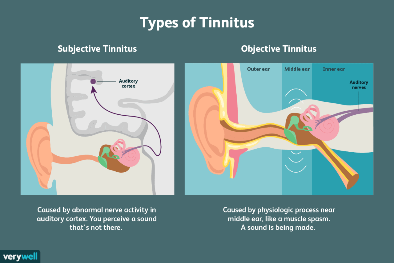 Saya sembuh dari tinnitus